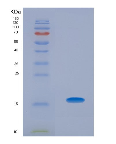 SDS-PAGE analysis of Human AHSP (Alpha-Hemoglobin-Stabilizing Protein) - Recombinant Protein, showing >85% purity under 15% SDS-PAGE (Reduced)
