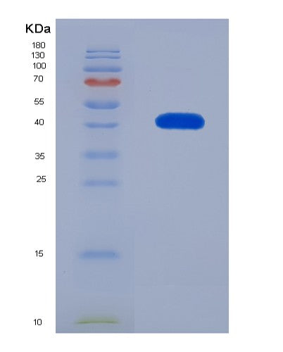 SDS-PAGE analysis of Human MAT2B (Methionine Adenosyltransferase 2 Subunit Beta) - Recombinant Protein, showing >85% purity under 15% SDS-PAGE (Reduced)