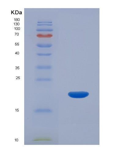 SDS-PAGE analysis of Human CALML5 (Calmodulin-Like Protein 5) - Recombinant Protein, showing >90% purity under 15% SDS-PAGE (Reduced)