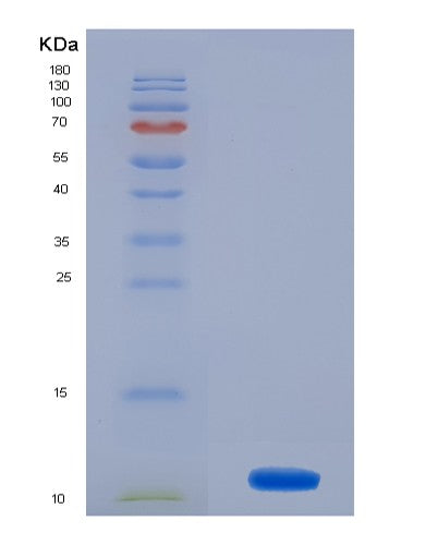 SDS-PAGE analysis of Human MSRB1 (Methionine-R-Sulfoxide Reductase B1) - Recombinant Protein, showing >85% purity under 15% SDS-PAGE (Reduced)