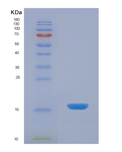 SDS-PAGE analysis of Human VAPA (Vesicle-Associated Membrane Protein-Associated Protein A) - Recombinant Protein, showing >85% purity under 15% SDS-PAGE (Reduced)