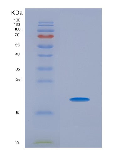 SDS-PAGE analysis of Mouse Pin1 (Peptidyl-Prolyl Cis-Trans Isomerase Nima-Interacting 1) - Recombinant Protein, showing >85% purity under 15% SDS-PAGE (Reduced)