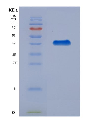 SDS-PAGE analysis of Human C3 (Complement C3) - Recombinant Protein, showing >90% purity under 15% SDS-PAGE (Reduced)