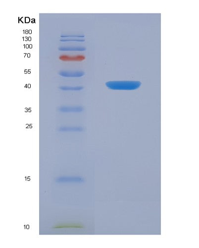 SDS-PAGE analysis of Human DKK3 (Dickkopf-Related Protein 3) - Recombinant Protein, showing >95% purity under 15% SDS-PAGE (Reduced)