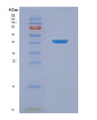 SDS-PAGE analysis of Human DKK3 (Dickkopf-Related Protein 3) - Recombinant Protein, showing >95% purity under 15% SDS-PAGE (Reduced)