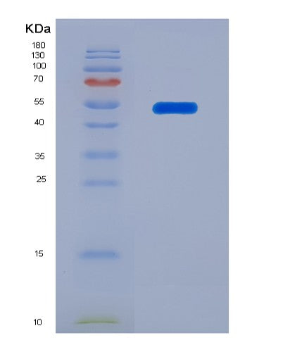 SDS-PAGE analysis of Human CHRNA9 (Neuronal Acetylcholine Receptor Subunit Alpha-9) - Recombinant Protein, showing >90% purity under 15% SDS-PAGE (Reduced)