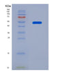 SDS-PAGE analysis of Human CHRNA9 (Neuronal Acetylcholine Receptor Subunit Alpha-9) - Recombinant Protein, showing >90% purity under 15% SDS-PAGE (Reduced)