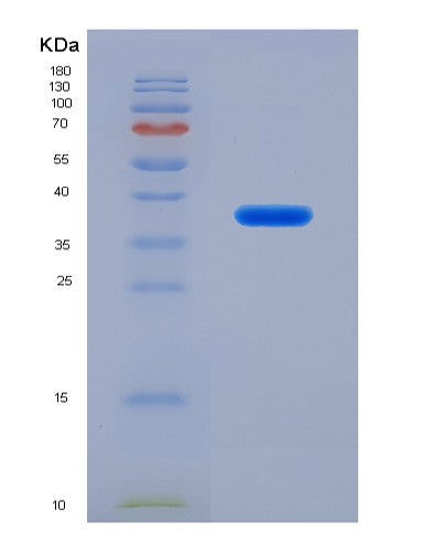 SDS-PAGE analysis of Human CTSZ (Cathepsin Z) - Recombinant Protein, showing >95% purity under 15% SDS-PAGE (Reduced)