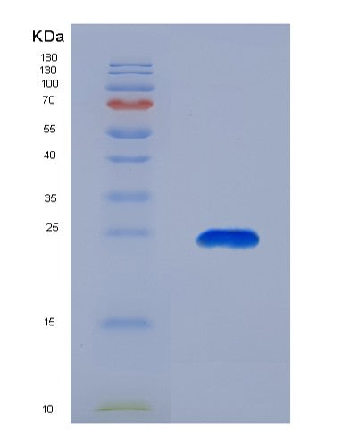 SDS-PAGE analysis of Human HSPB7 (Heat Shock Protein Beta-7) - Recombinant Protein, showing >95% purity under 15% SDS-PAGE (Reduced)