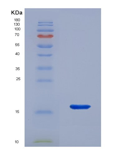 SDS-PAGE analysis of Human LAMTOR3 (Ragulator Complex Protein Lamtor3) - Recombinant Protein, showing >95% purity under 15% SDS-PAGE (Reduced)
