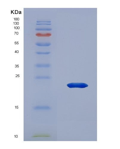 SDS-PAGE analysis of Human IL36A (Interleukin-36 Alpha) - Recombinant Protein, showing >90% purity under 15% SDS-PAGE (Reduced)