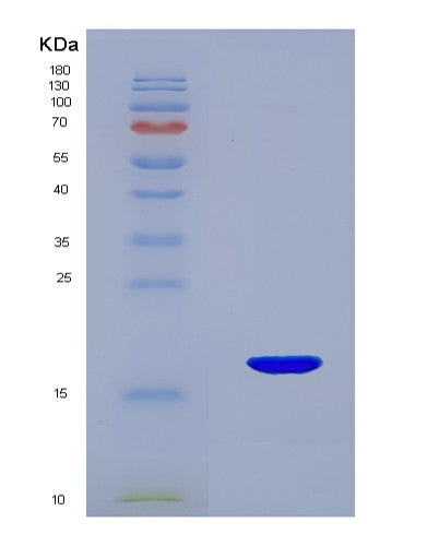 SDS-PAGE analysis of Human TAC3 (Tachykinin-3) - Recombinant Protein, showing >90% purity under 15% SDS-PAGE (Reduced)