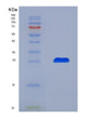 SDS-PAGE analysis of Human MSRA (Mitochondrial Peptide Methionine Sulfoxide Reductase) - Recombinant Protein, showing >85% purity under 15% SDS-PAGE (Reduced)