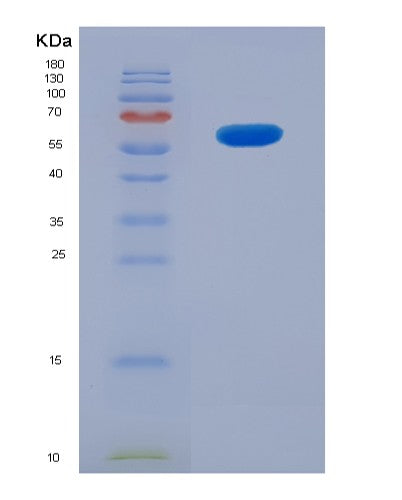 SDS-PAGE analysis of Human CD207 (C-Type Lectin Domain Family 4 Member K) - Recombinant Protein, showing >85% purity under 15% SDS-PAGE (Reduced)