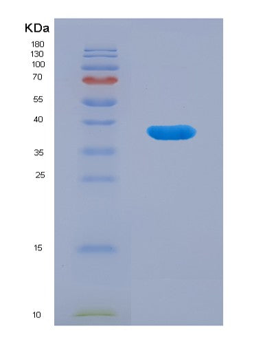 SDS-PAGE analysis of Human ANXA10 (Annexin A10) - Recombinant Protein, showing >90% purity under 15% SDS-PAGE (Reduced)
