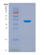 SDS-PAGE analysis of Human ANXA10 (Annexin A10) - Recombinant Protein, showing >90% purity under 15% SDS-PAGE (Reduced)