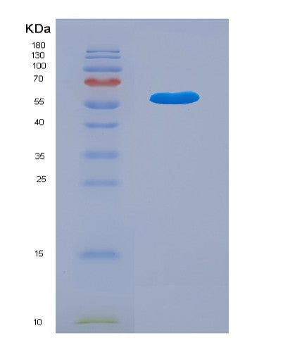 SDS-PAGE analysis of Human CTSG (Cathepsin G) - Recombinant Protein, showing >90% purity under 15% SDS-PAGE (Reduced)