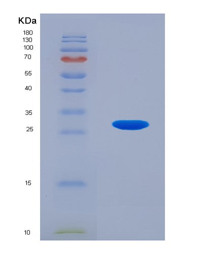 SDS-PAGE analysis of Human ANGPTL2 (Angiopoietin-Related Protein 2) - Recombinant Protein, showing >85% purity under 15% SDS-PAGE (Reduced)