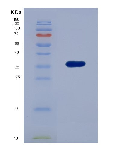 SDS-PAGE analysis of Human EDAR (Tumor Necrosis Factor Receptor Superfamily Member Edar) - Recombinant Protein, showing >85% purity under 15% SDS-PAGE (Reduced)