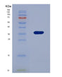 SDS-PAGE analysis of Human EDAR (Tumor Necrosis Factor Receptor Superfamily Member Edar) - Recombinant Protein, showing >85% purity under 15% SDS-PAGE (Reduced)
