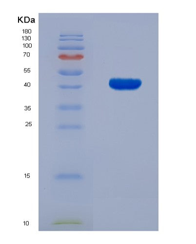SDS-PAGE analysis of Human PSMD13 (26S Proteasome Non-Atpase Regulatory Subunit 13) - Recombinant Protein, showing >85% purity under 15% SDS-PAGE (Reduced)