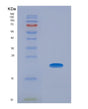 SDS-PAGE analysis of Human PROCR (Endothelial Protein C Receptor) - Recombinant Protein, showing >85% purity under 15% SDS-PAGE (Reduced)