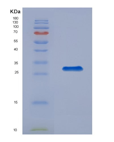 SDS-PAGE analysis of Human PPIE (Peptidyl-Prolyl Cis-Trans Isomerase E) - Recombinant Protein, showing >85% purity under 15% SDS-PAGE (Reduced)
