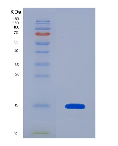 SDS-PAGE analysis of Human PIN4 (Peptidyl-Prolyl Cis-Trans Isomerase Nima-Interacting 4) - Recombinant Protein, showing >95% purity under 15% SDS-PAGE (Reduced)