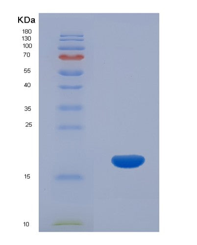 SDS-PAGE analysis of Human CCL26 (C-C Motif Chemokine 26) - Recombinant Protein, showing >90% purity under 15% SDS-PAGE (Reduced)