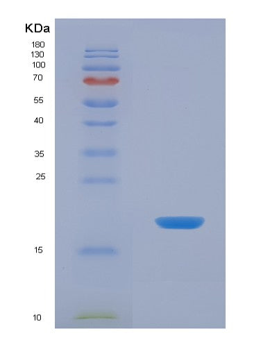 SDS-PAGE analysis of Human GPC1 (Glypican-1) - Recombinant Protein, showing >90% purity under 15% SDS-PAGE (Reduced)