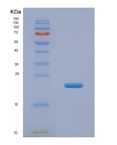 SDS-PAGE analysis of Human CFL2 (Cofilin-2) - Recombinant Protein, showing >95% purity under 15% SDS-PAGE (Reduced)