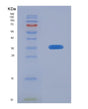 SDS-PAGE analysis of Human CA5B (Carbonic Anhydrase 5B, Mitochondrial) - Recombinant Protein, showing >95% purity under 15% SDS-PAGE (Reduced)