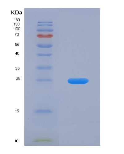 SDS-PAGE analysis of Human GDA (Guanine Deaminase) - Recombinant Protein, showing >90% purity under 15% SDS-PAGE (Reduced)