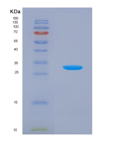 SDS-PAGE analysis of Human KLK5 (Kallikrein-5) - Recombinant Protein, showing >90% purity under 15% SDS-PAGE (Reduced)