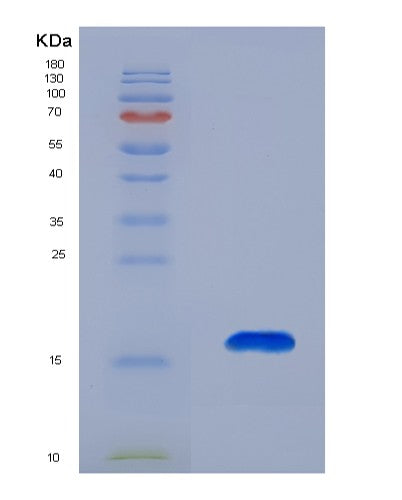 SDS-PAGE analysis of Human CCL27 (C-C Motif Chemokine 27) - Recombinant Protein, showing >85% purity under 15% SDS-PAGE (Reduced)