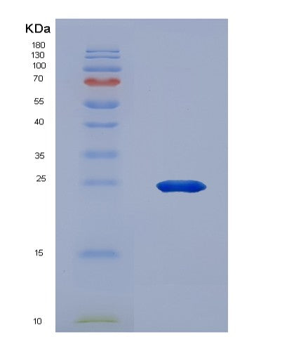 SDS-PAGE analysis of Human ANGPTL3 (Angiopoietin-Related Protein 3) - Recombinant Protein, showing >90% purity under 15% SDS-PAGE (Reduced)