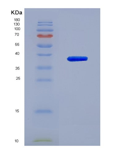 SDS-PAGE analysis of Human UCHL5 (Ubiquitin Carboxyl-Terminal Hydrolase Isozyme L5) - Recombinant Protein, showing >85% purity under 15% SDS-PAGE (Reduced)