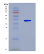 SDS-PAGE analysis of Human UCHL5 (Ubiquitin Carboxyl-Terminal Hydrolase Isozyme L5) - Recombinant Protein, showing >85% purity under 15% SDS-PAGE (Reduced)