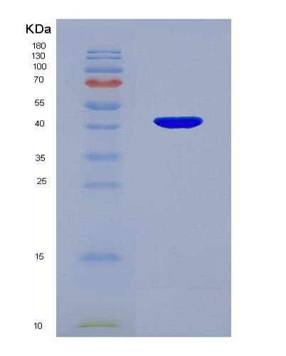 SDS-PAGE analysis of Human WIF1 (Wnt Inhibitory Factor 1) - Recombinant Protein, showing >85% purity under 15% SDS-PAGE (Reduced)