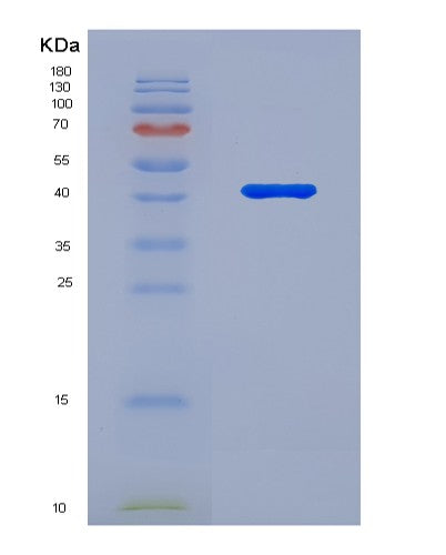 SDS-PAGE analysis of Human PSAT1 (Phosphoserine Aminotransferase) - Recombinant Protein, showing >95% purity under 15% SDS-PAGE (Reduced)