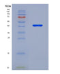 SDS-PAGE analysis of Human PSAT1 (Phosphoserine Aminotransferase) - Recombinant Protein, showing >95% purity under 15% SDS-PAGE (Reduced)