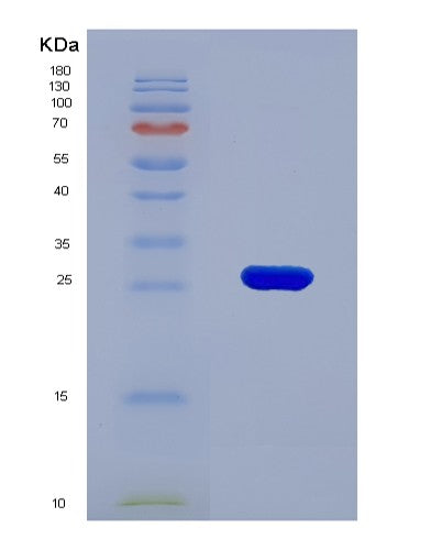 SDS-PAGE analysis of Human F11R (Junctional Adhesion Molecule A) - Recombinant Protein, showing >90% purity under 15% SDS-PAGE (Reduced)