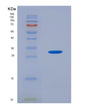 SDS-PAGE analysis of Human Parkinson Disease 2 (PARK2) - Recombinant Protein, showing >85% purity under 15% SDS-PAGE (Reduced)