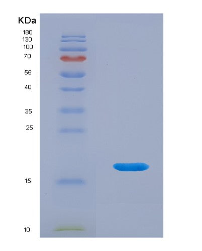 SDS-PAGE analysis of Human CDNF (Cerebral Dopamine Neurotrophic Factor) - Recombinant Protein, showing >95% purity under 15% SDS-PAGE (Reduced)