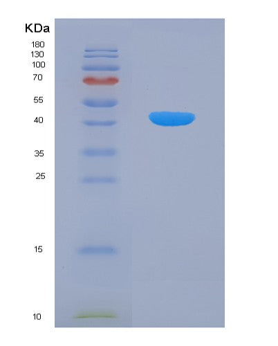 SDS-PAGE analysis of Human TNFSF13B (Tumor Necrosis Factor Ligand Superfamily Member 13B) - Recombinant Protein, showing >90% purity under 15% SDS-PAGE (Reduced)