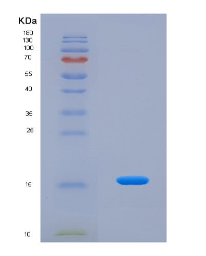 SDS-PAGE analysis of Human FABP4 (Fatty Acid-Binding Protein, Adipocyte) - Recombinant Protein, showing >90% purity under 15% SDS-PAGE (Reduced)