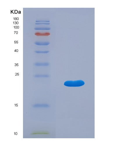 SDS-PAGE analysis of Human IFNA5 (Interferon Alpha-5) - Recombinant Protein, showing >90% purity under 15% SDS-PAGE (Reduced)