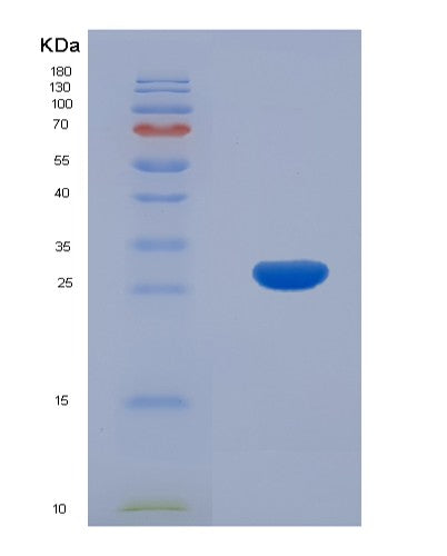 SDS-PAGE analysis of Mouse Sh2b3 (Sh2B Adapter Protein 3) - Recombinant Protein, showing >90% purity under 15% SDS-PAGE (Reduced)