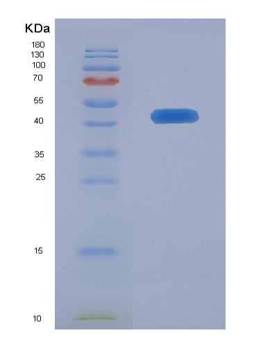 SDS-PAGE analysis of Human MFN2 (Mitofusin-2) - Recombinant Protein, showing >90% purity under 15% SDS-PAGE (Reduced)