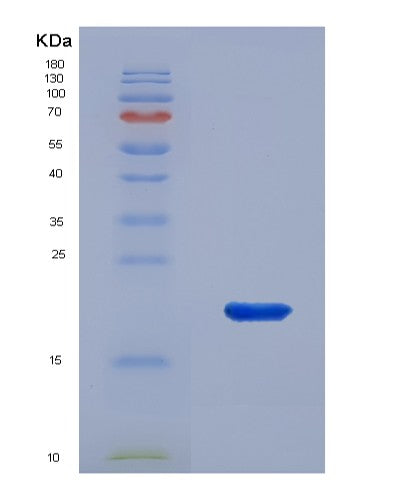 SDS-PAGE analysis of Human COL18A1 (Collagen Alpha-1(Xviii) Chain) - Recombinant Protein, showing >90% purity under 15% SDS-PAGE (Reduced)